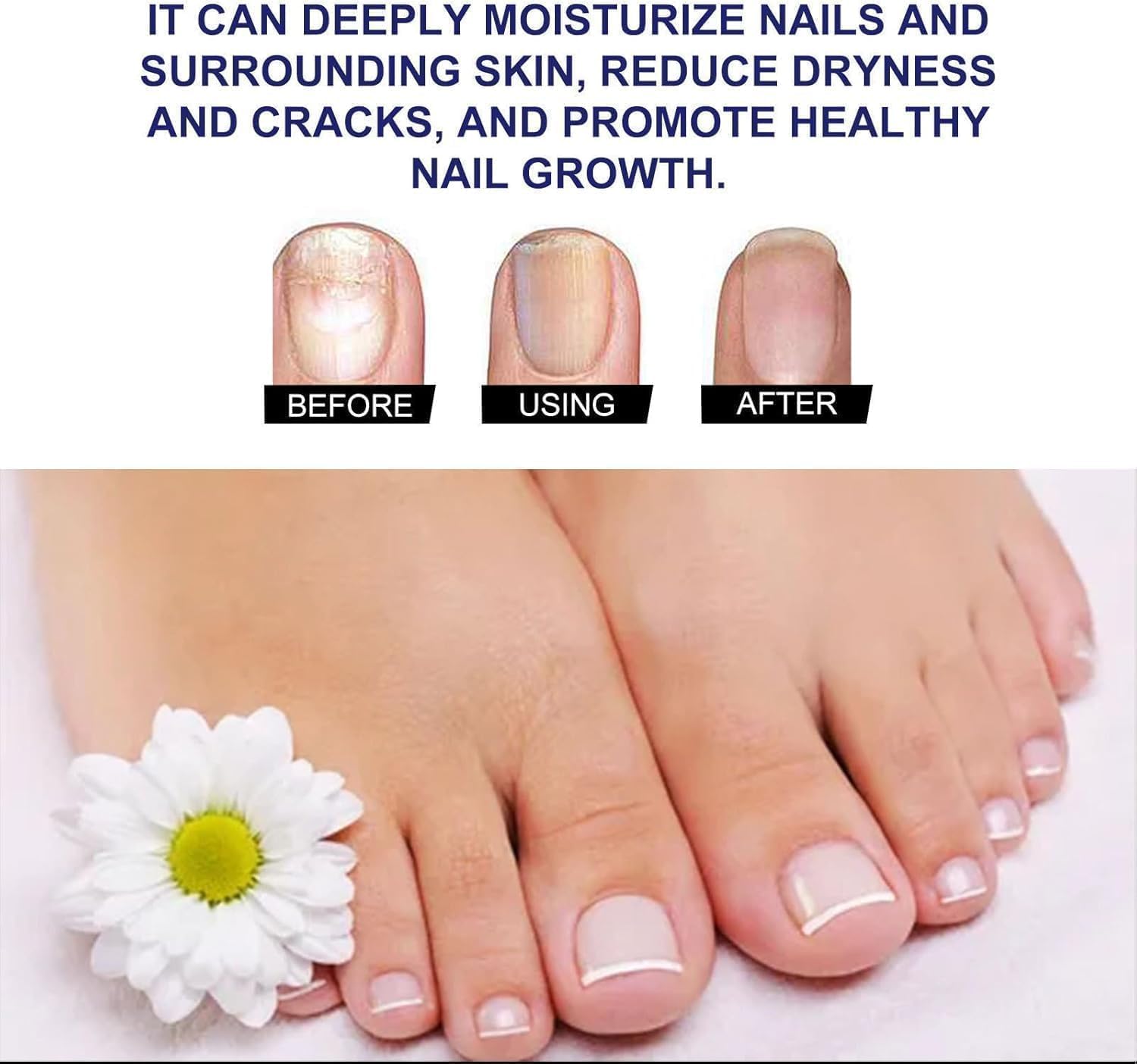 Ginger Nail Treatment Nail Support Nail Care