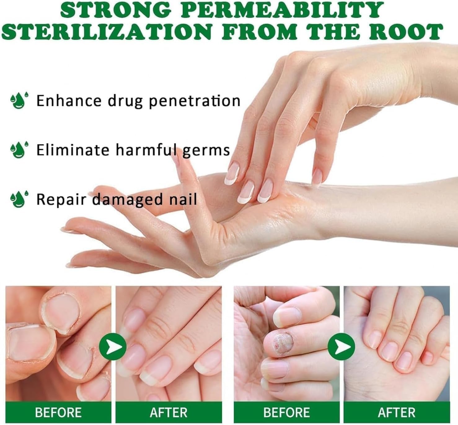 Ginger Nail Treatment Nail Support Nail Care