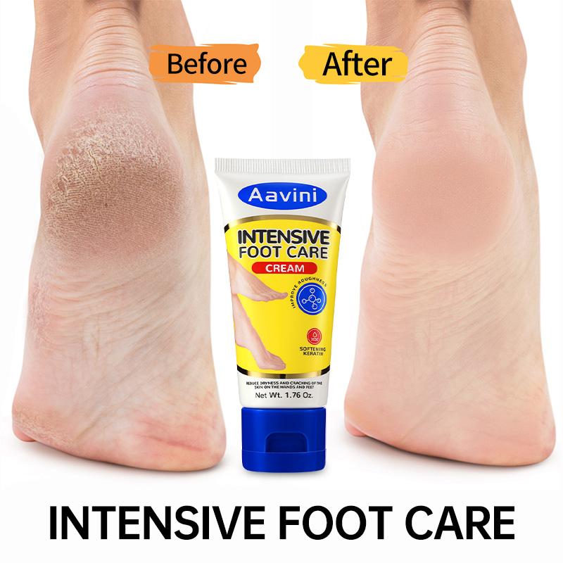 Aavini Intense Foot Cream - Repairs Cracked Skin, Antibacterial and Deodorizing, Removes and Softens Calluses, For All Skin Types, Moisturizing Foot Lotion